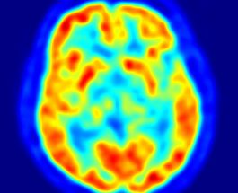 Descoperire surprinzătoare